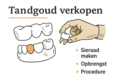 Tandgoud-verkopen